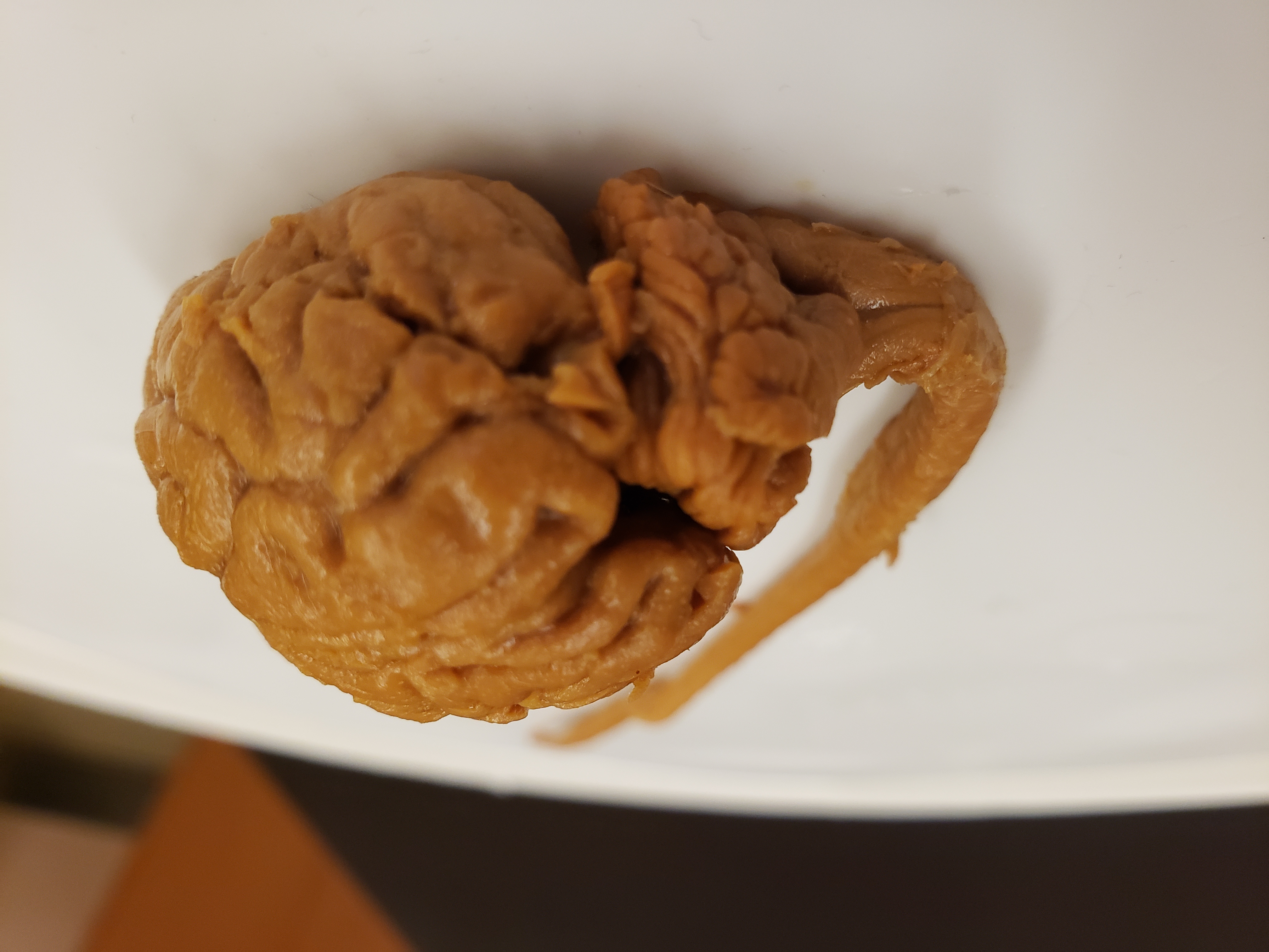 Fetal pig brain dissection - grade 11 Biology Open Gallery